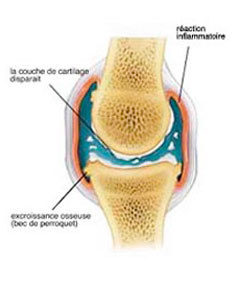 Articulation d’un cheval avec du cartilage endommagé, des croissances osseuses et une inflammation de la capsule articulaire.